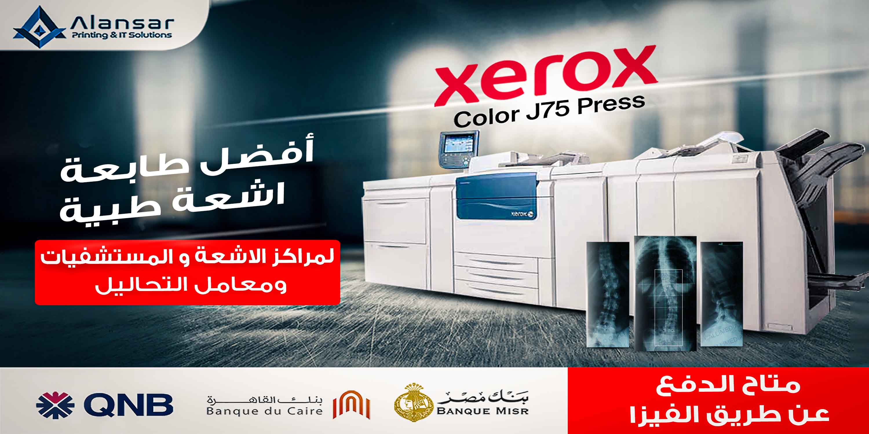 Xerox J75: The best medical radiology printer